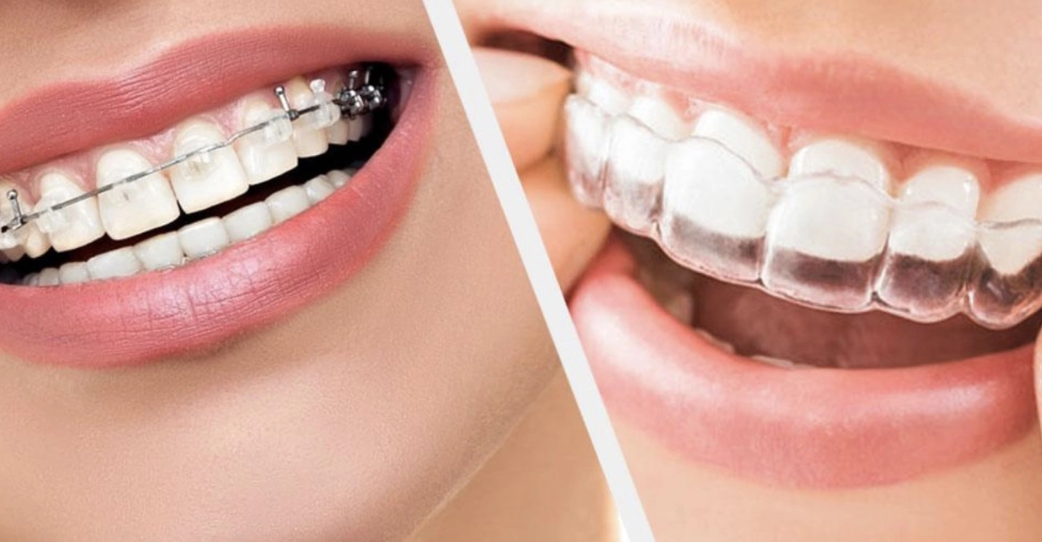 How important is orthodontic treatment Inblog